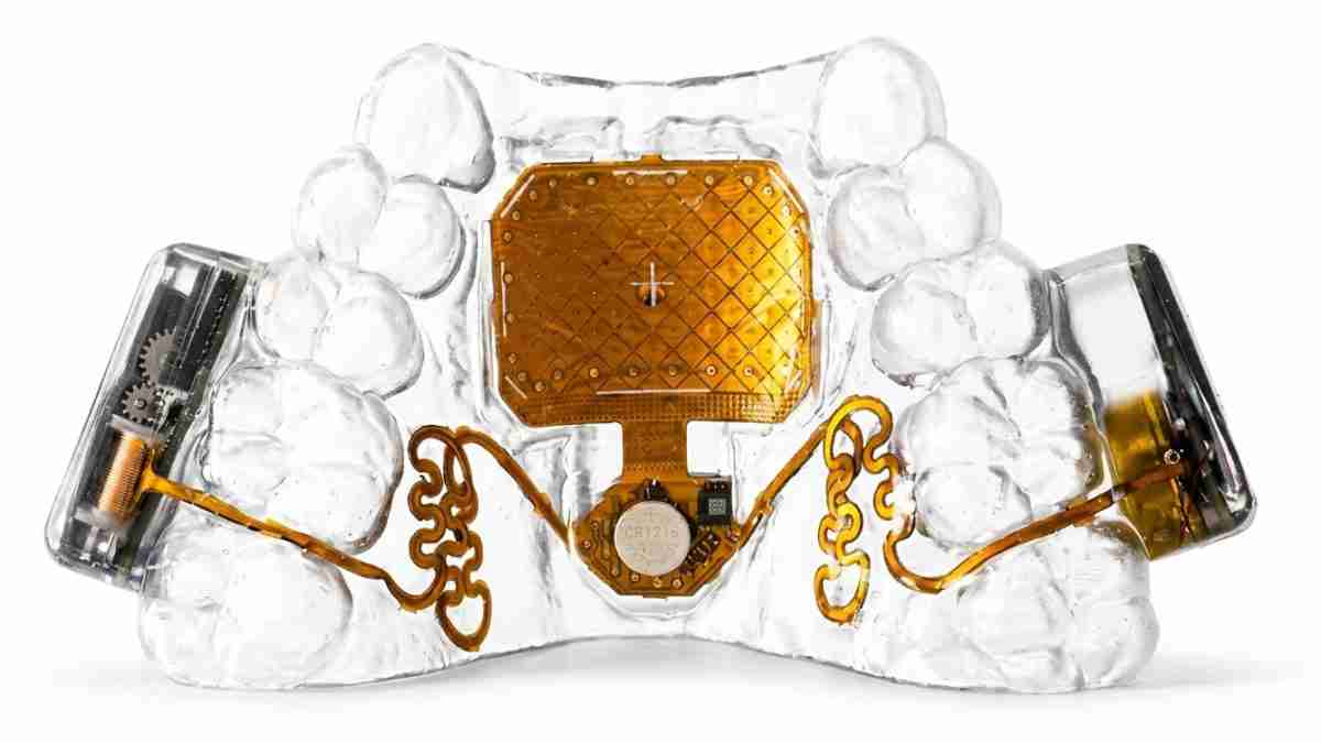Dental jaw model displaying a gold rectangular implant with orange wiring and connectors embedded in the transparent resin.