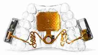 Dental jaw model displaying a gold rectangular implant with orange wiring and connectors embedded in the transparent resin.